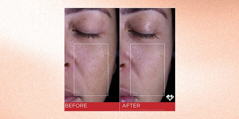 Before and after using spf cream